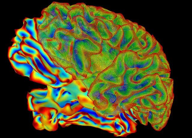 סריקת מוח, fMRI, SUMA