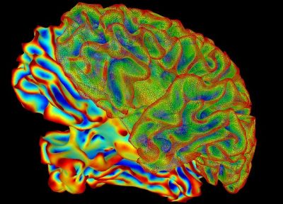fMRI, מוח, סריקה
