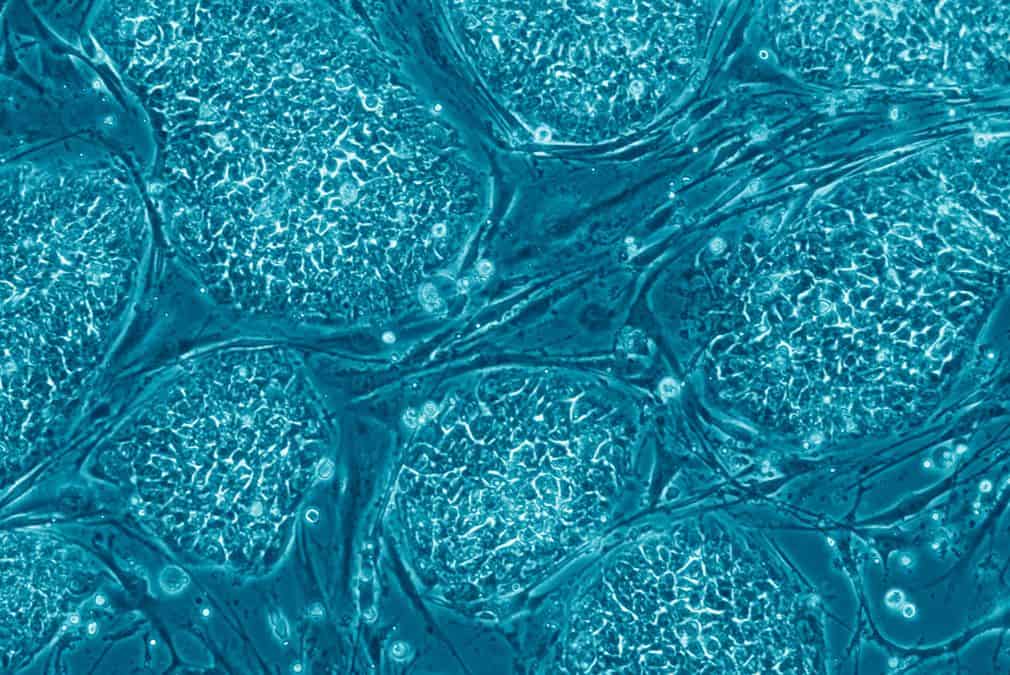 תאי גזע עובריים
