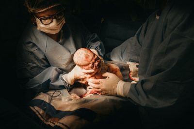 לידה, ניתוח קיסרי, תינוק, רופאים